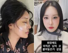 拉拉，整形後臉龐大變樣讓人困惑…「李名華變得太年輕了」