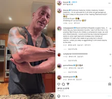 드웨인 존슨, 영화 〈더 스매싱 머신〉 촬영 중 팔꿈치 부상