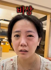 高恩雅，拍攝前因眼睛過敏而驚慌！公開重大情況