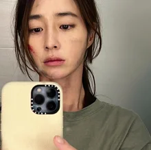 [Photo &] Lee Min-jung, Face Covered in Bruises…'Villains' Overnight Filming Set