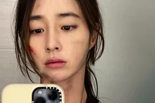 [Photo &] Lee Min-jung, Face Covered in Bruises…'Villains' Overnight Filming Set